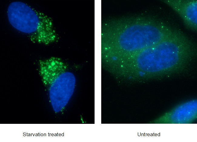 P62/SQSTM1 Antibody in Immunocytochemistry (ICC/IF)