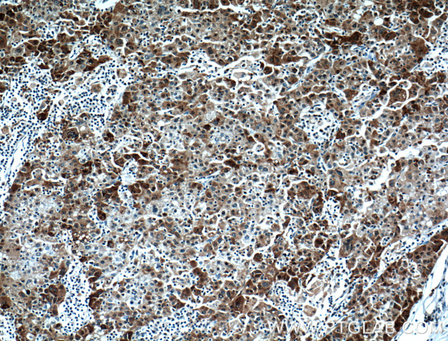 P62/SQSTM1 Antibody in Immunohistochemistry (Paraffin) (IHC (P))