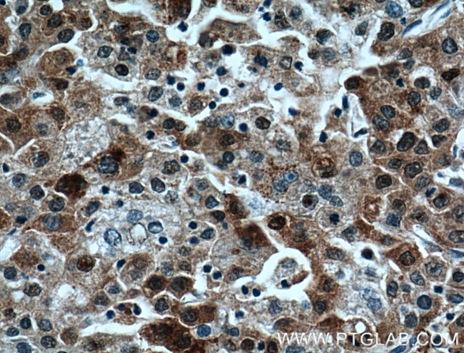 P62/SQSTM1 Antibody in Immunohistochemistry (Paraffin) (IHC (P))