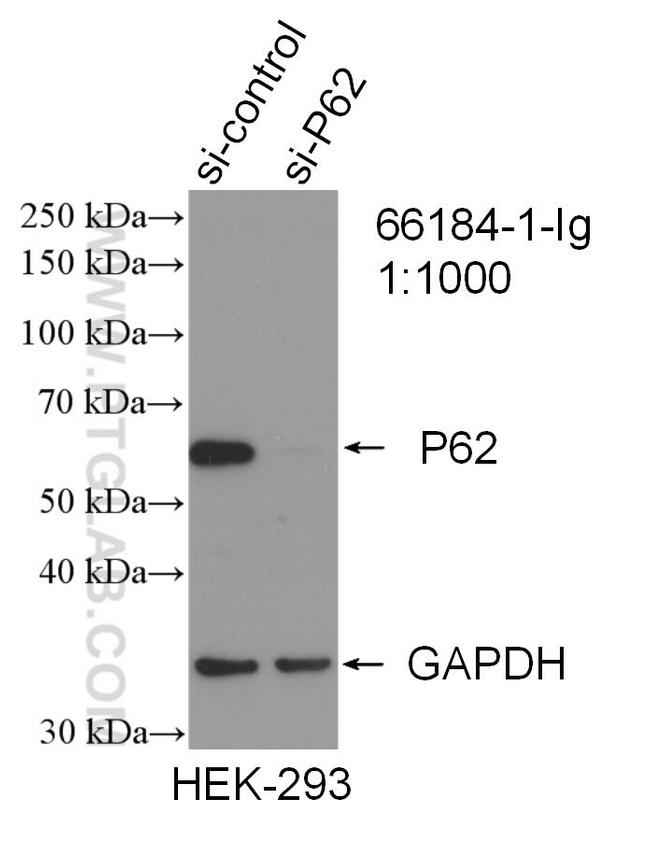 P62/SQSTM1 Antibody in Western Blot (WB)