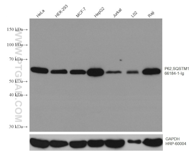 P62/SQSTM1 Antibody in Western Blot (WB)