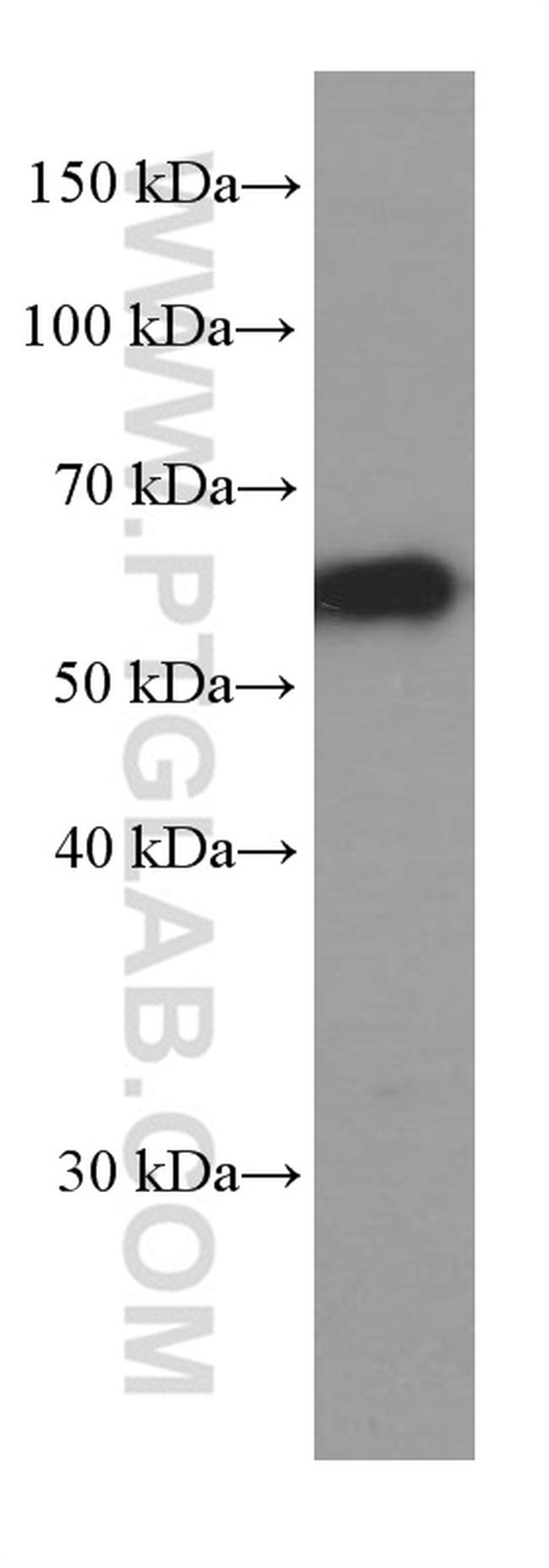 P62/SQSTM1 Antibody in Western Blot (WB)