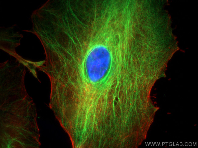 Cytokeratin 18 Antibody in Immunocytochemistry (ICC/IF)