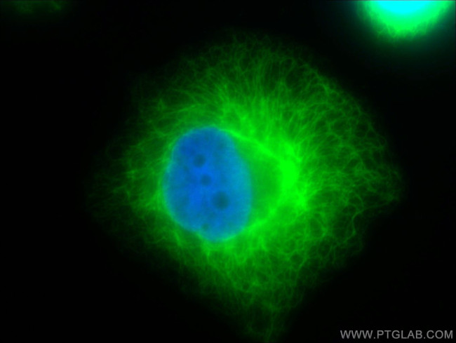 Cytokeratin 18 Antibody in Immunocytochemistry (ICC/IF)