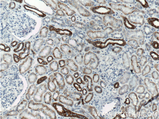 Cytokeratin 18 Antibody in Immunohistochemistry (Paraffin) (IHC (P))