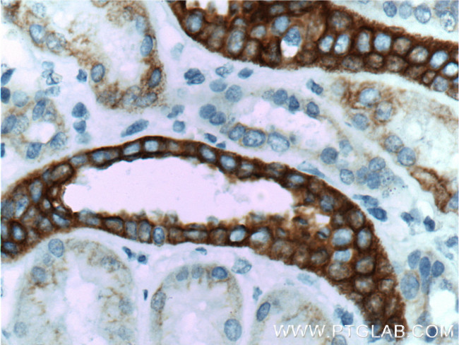 Cytokeratin 18 Antibody in Immunohistochemistry (Paraffin) (IHC (P))