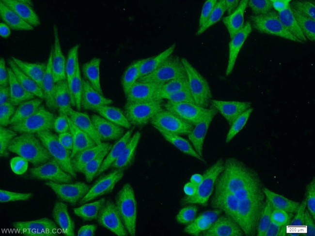 Cytokeratin 18 Antibody in Immunocytochemistry (ICC/IF)