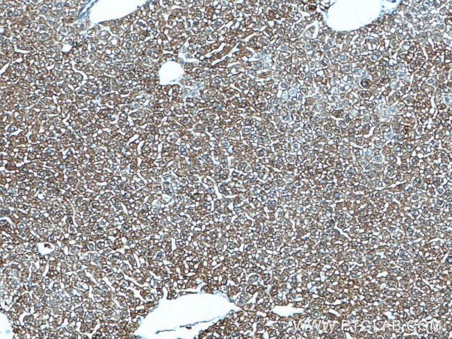 Cytokeratin 18 Antibody in Immunohistochemistry (Paraffin) (IHC (P))