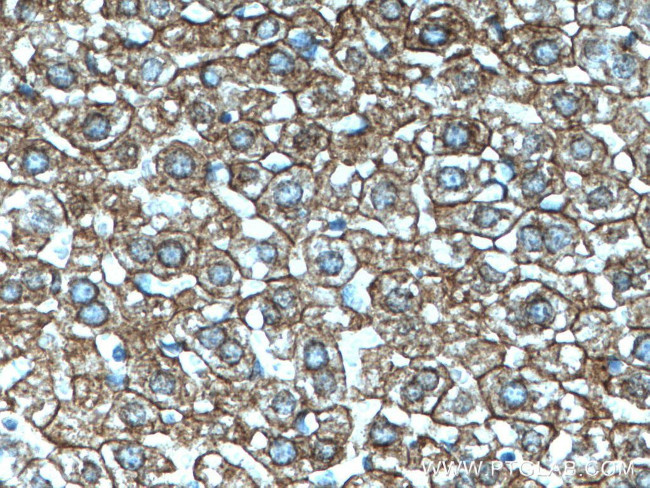 Cytokeratin 18 Antibody in Immunohistochemistry (Paraffin) (IHC (P))