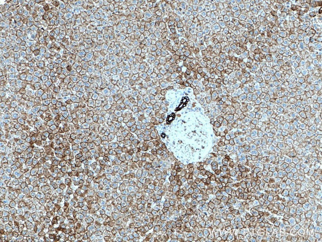 Cytokeratin 18 Antibody in Immunohistochemistry (Paraffin) (IHC (P))