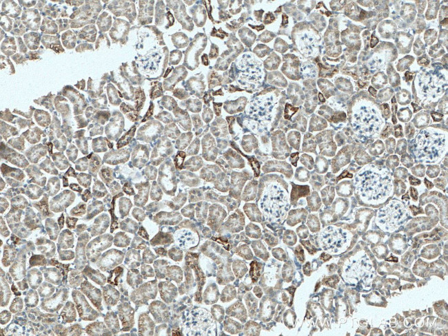 Cytokeratin 18 Antibody in Immunohistochemistry (Paraffin) (IHC (P))