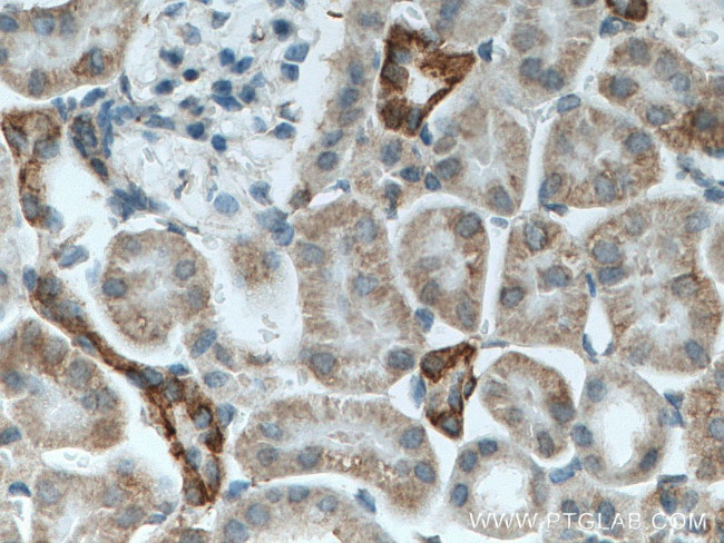 Cytokeratin 18 Antibody in Immunohistochemistry (Paraffin) (IHC (P))