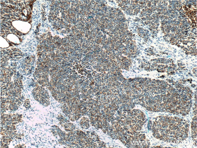 Cytokeratin 18 Antibody in Immunohistochemistry (Paraffin) (IHC (P))