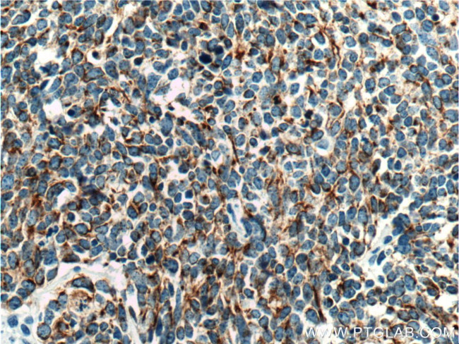 Cytokeratin 18 Antibody in Immunohistochemistry (Paraffin) (IHC (P))