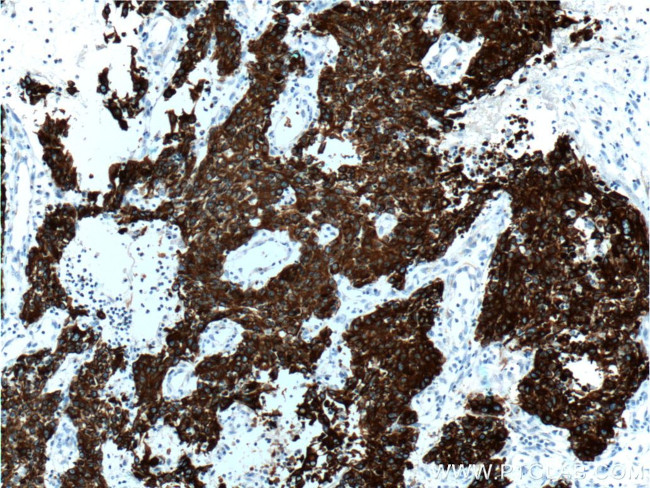 Cytokeratin 18 Antibody in Immunohistochemistry (Paraffin) (IHC (P))