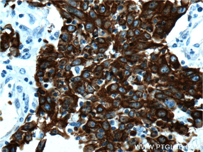 Cytokeratin 18 Antibody in Immunohistochemistry (Paraffin) (IHC (P))