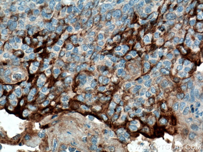 Cytokeratin 18 Antibody in Immunohistochemistry (Paraffin) (IHC (P))