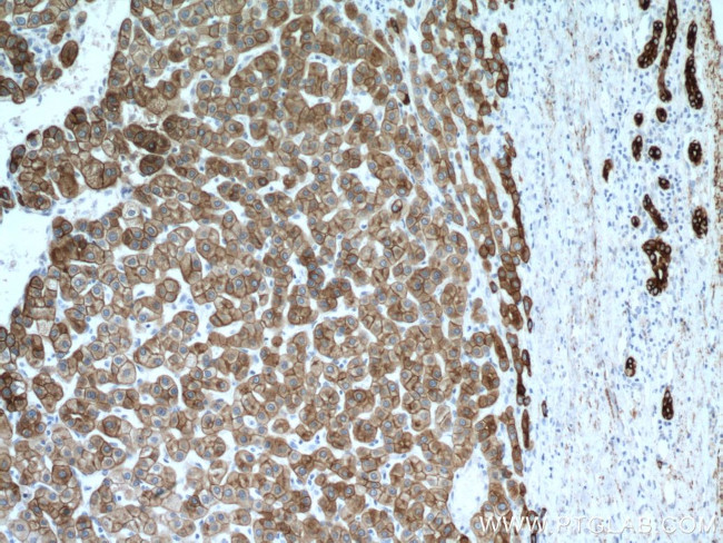 Cytokeratin 18 Antibody in Immunohistochemistry (Paraffin) (IHC (P))