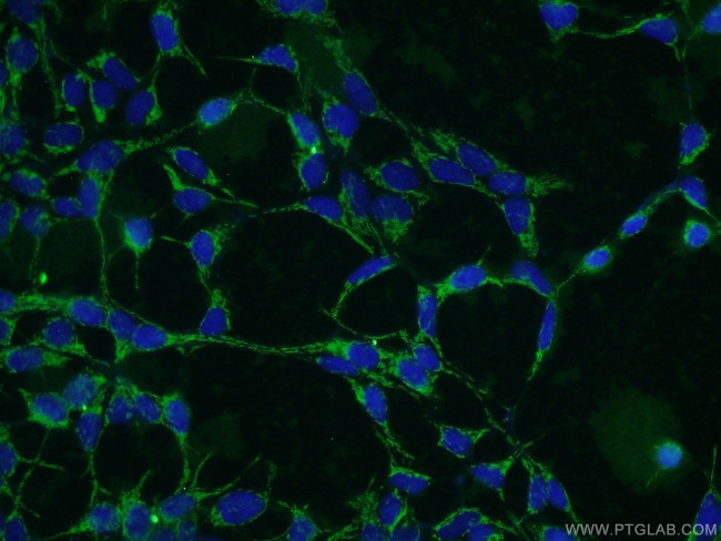 STIM1 Antibody in Immunocytochemistry (ICC/IF)