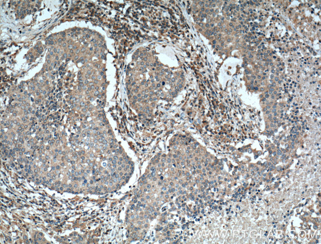 STIM1 Antibody in Immunohistochemistry (Paraffin) (IHC (P))