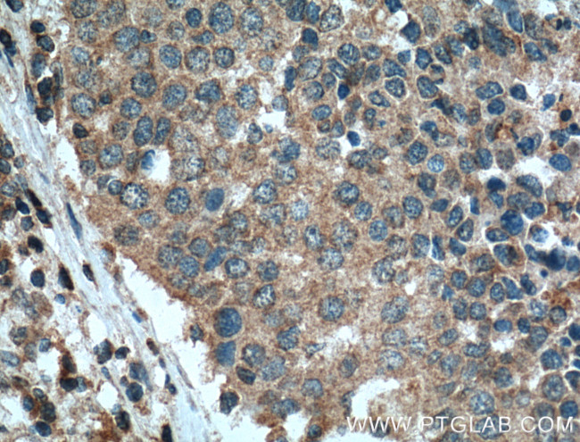 STIM1 Antibody in Immunohistochemistry (Paraffin) (IHC (P))