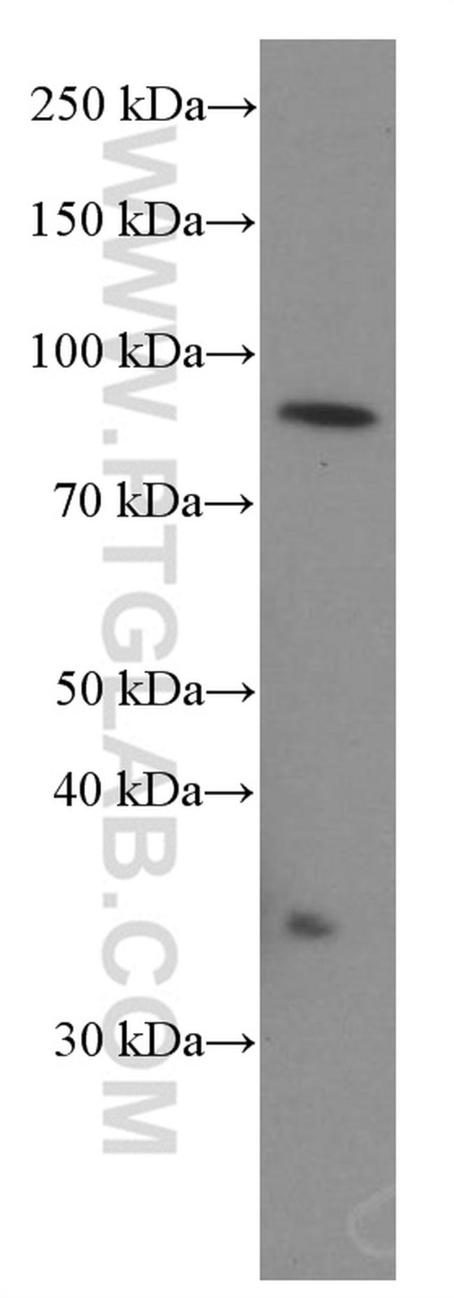 STIM1 Antibody in Western Blot (WB)