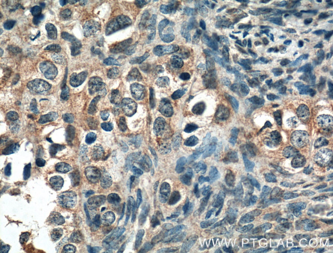 STIM1 Antibody in Immunohistochemistry (Paraffin) (IHC (P))