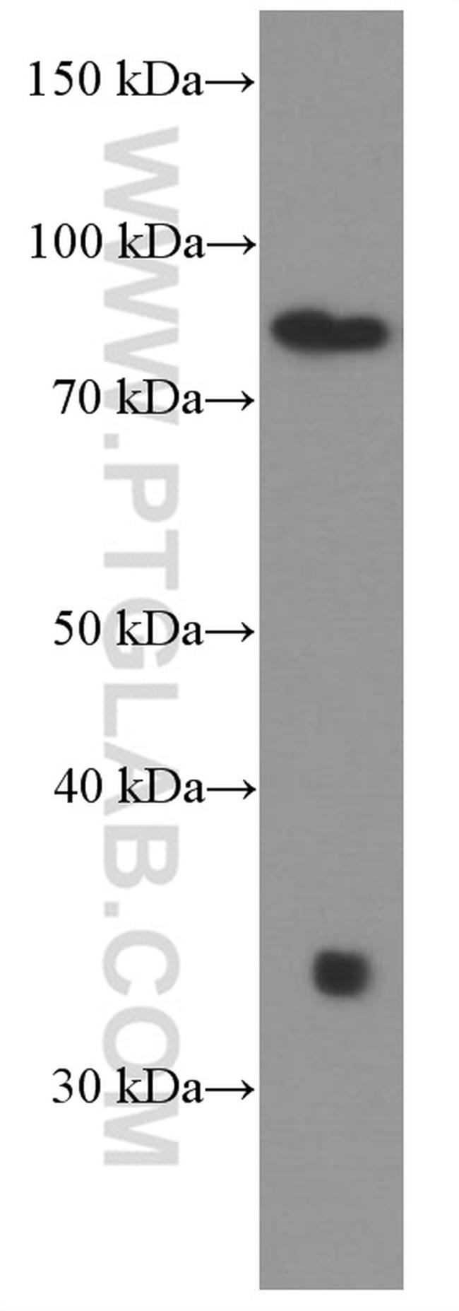 STIM1 Antibody in Western Blot (WB)