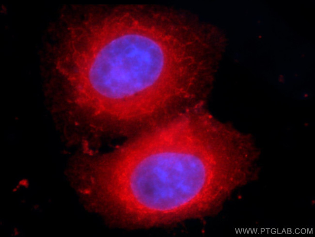 VAPB Antibody in Immunocytochemistry (ICC/IF)