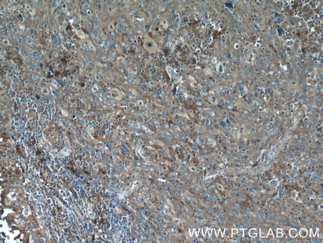 VAPB Antibody in Immunohistochemistry (Paraffin) (IHC (P))