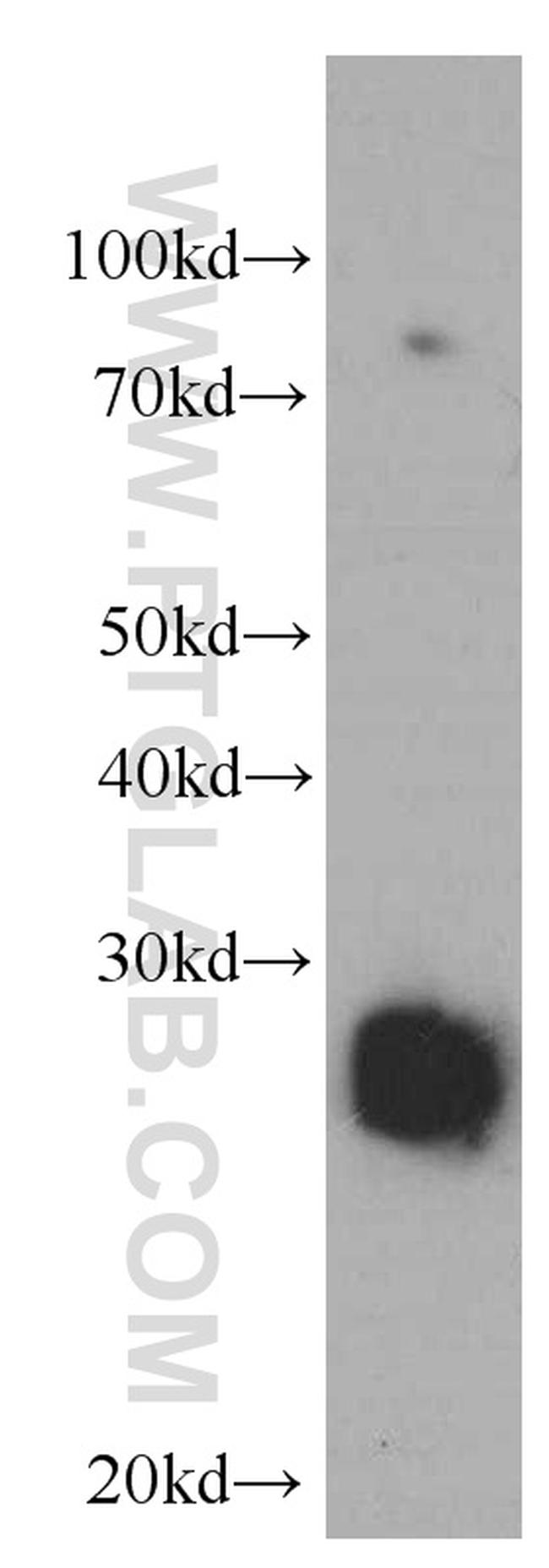 VAPB Antibody in Western Blot (WB)