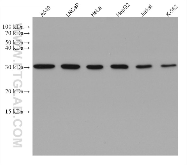 VAPB Antibody in Western Blot (WB)