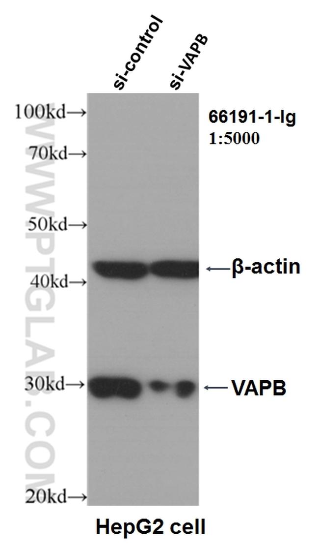 VAPB Antibody in Western Blot (WB)