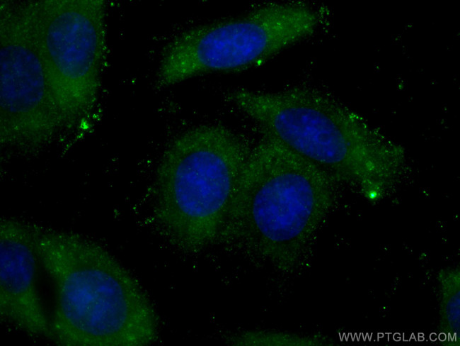 GSNOR/ADH5 Antibody in Immunocytochemistry (ICC/IF)