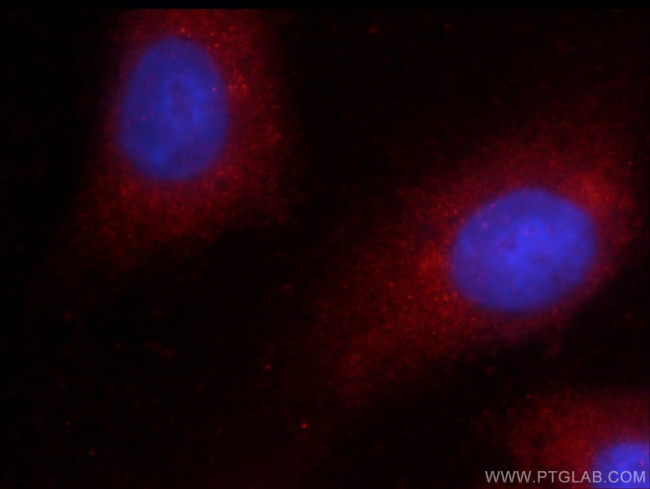 GSNOR/ADH5 Antibody in Immunocytochemistry (ICC/IF)