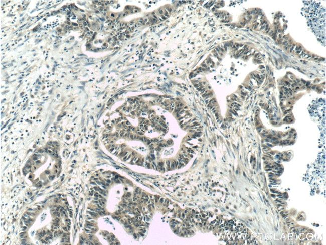 GSNOR/ADH5 Antibody in Immunohistochemistry (Paraffin) (IHC (P))