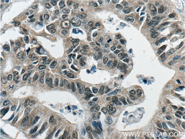 GSNOR/ADH5 Antibody in Immunohistochemistry (Paraffin) (IHC (P))