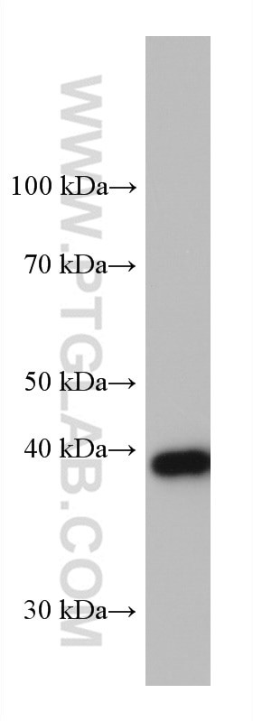 GSNOR/ADH5 Antibody in Western Blot (WB)