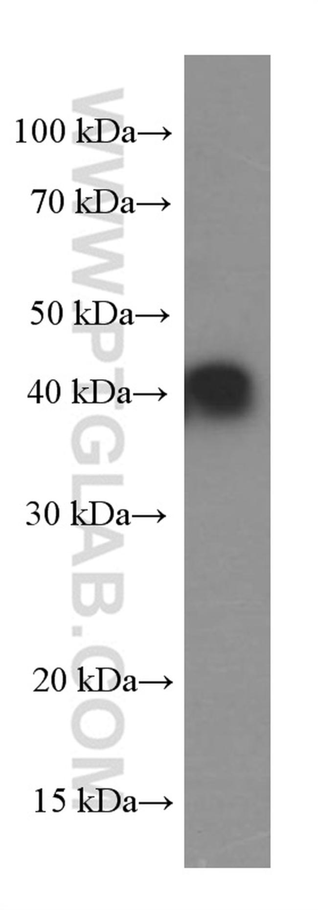 GSNOR/ADH5 Antibody in Western Blot (WB)