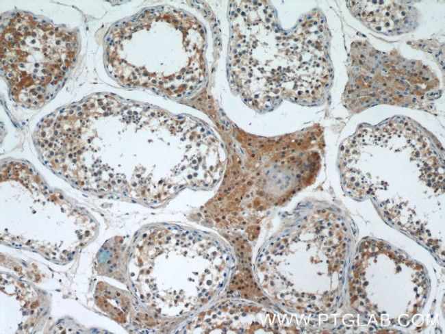 GSNOR/ADH5 Antibody in Immunohistochemistry (Paraffin) (IHC (P))