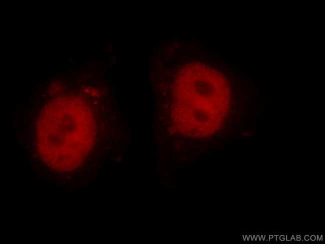 MTA2 Antibody in Immunocytochemistry (ICC/IF)