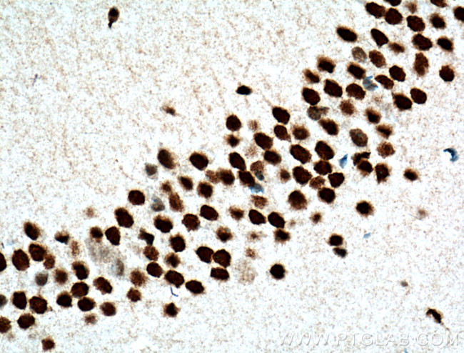 MTA2 Antibody in Immunohistochemistry (Paraffin) (IHC (P))