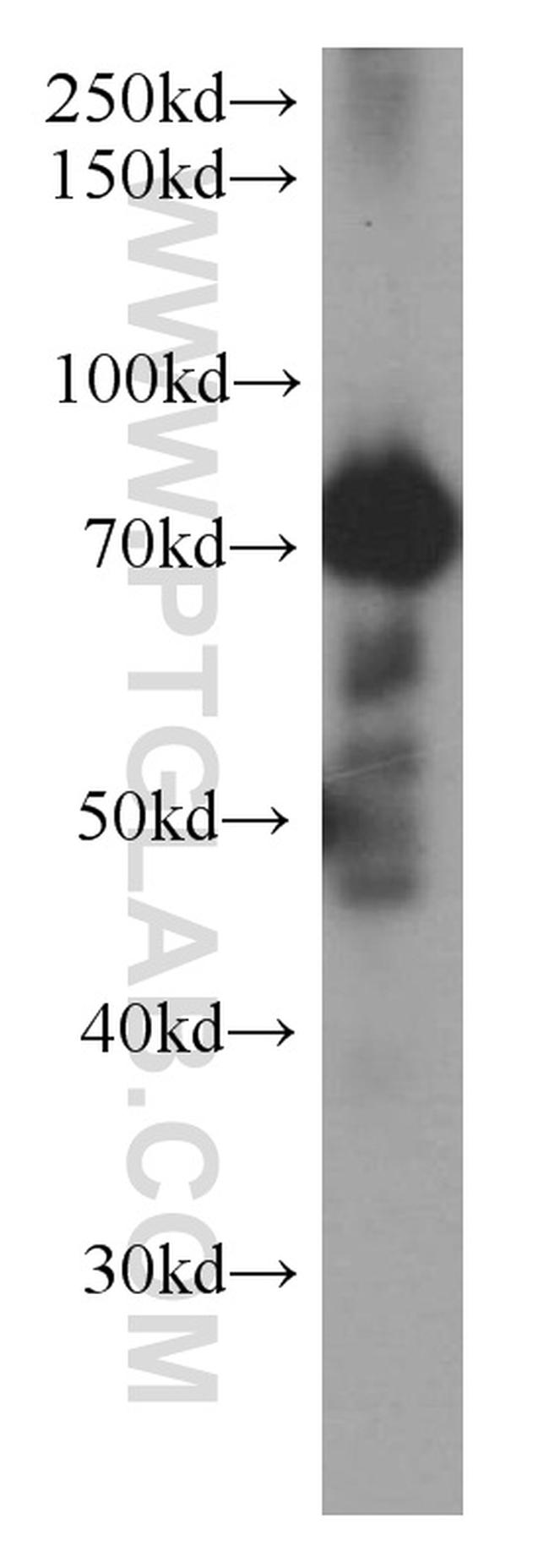 MTA2 Antibody in Western Blot (WB)