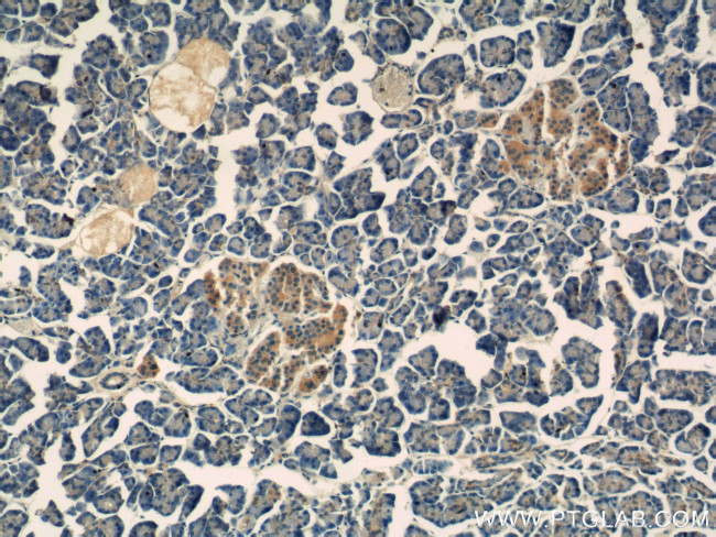 IDH1 Antibody in Immunohistochemistry (Paraffin) (IHC (P))