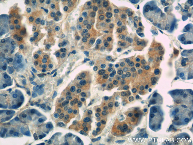 IDH1 Antibody in Immunohistochemistry (Paraffin) (IHC (P))