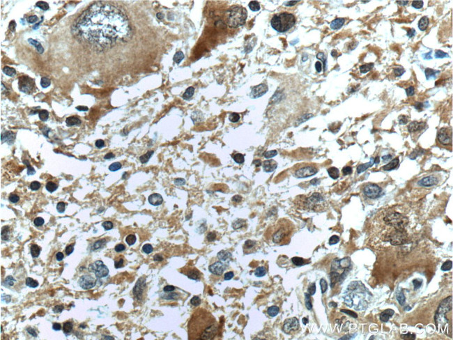 IDH1 Antibody in Immunohistochemistry (Paraffin) (IHC (P))