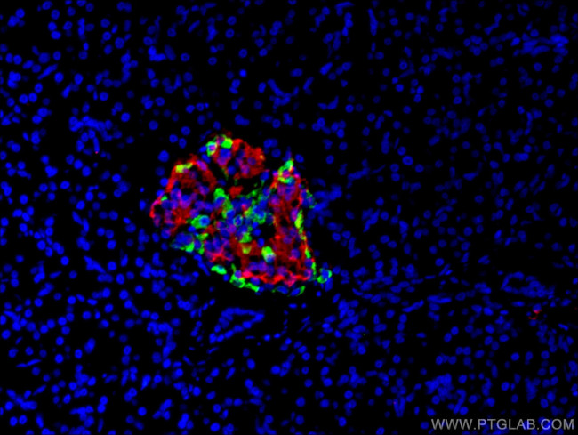 Insulin Antibody in Immunocytochemistry (ICC/IF)