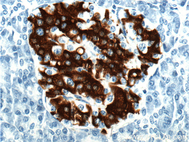 Insulin Antibody in Immunohistochemistry (Paraffin) (IHC (P))