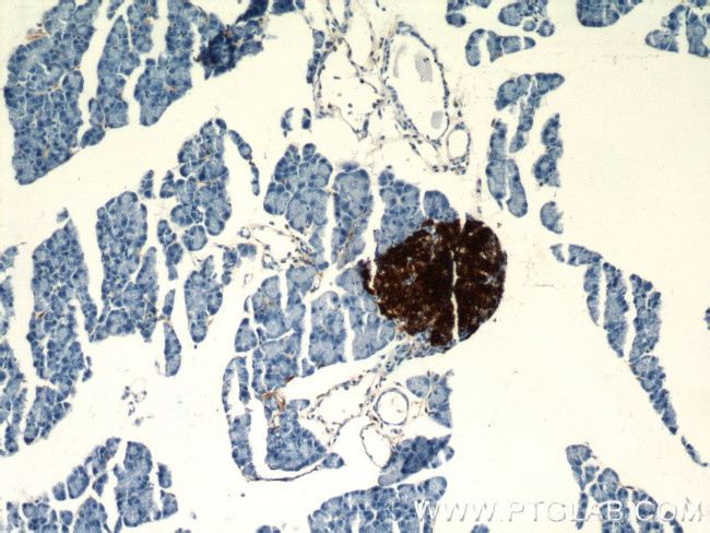 Insulin Antibody in Immunohistochemistry (Paraffin) (IHC (P))