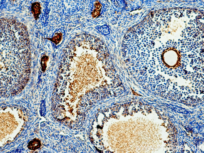 acetylated Tubulin(Lys40) Antibody in Immunohistochemistry (Paraffin) (IHC (P))